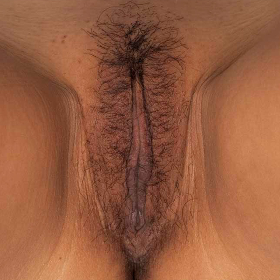 Vulva viewed from underneath. The model has medium-dark skin tone. Labia minora are visible. Labia majora skin texture is covered by pubic hair. There is black pubic hair on the vulva.